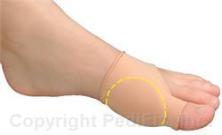 PEDIFIX VISCO-GEL BUNION RELIEF SLEEVE PEDIFIX VISCO-GEL BUNION RELIEF SLEEVE Bunion Relief PediFix - Americare Medical Supply