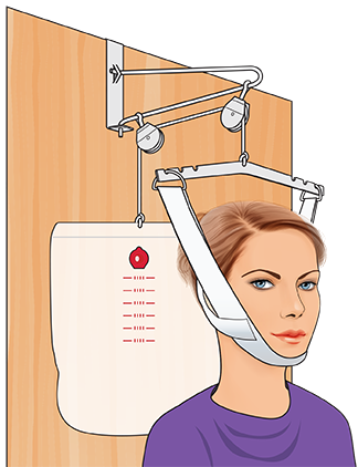 Nova Overdoor Traction Set Nova Overdoor Traction Set Traction Sets Nova Medical - Americare Medical Supply